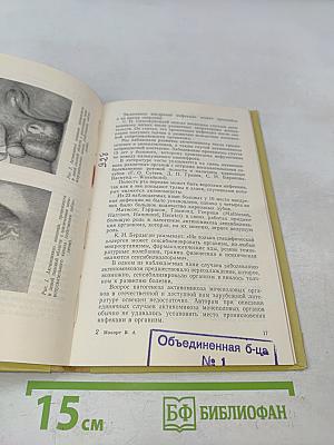 Актиномикоз мочеполовых органов