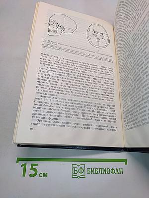 Форма и конструкция черепа
