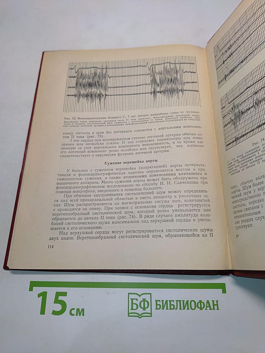Краткое руководство по фонокардиографии
