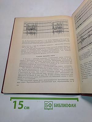 Краткое руководство по фонокардиографии