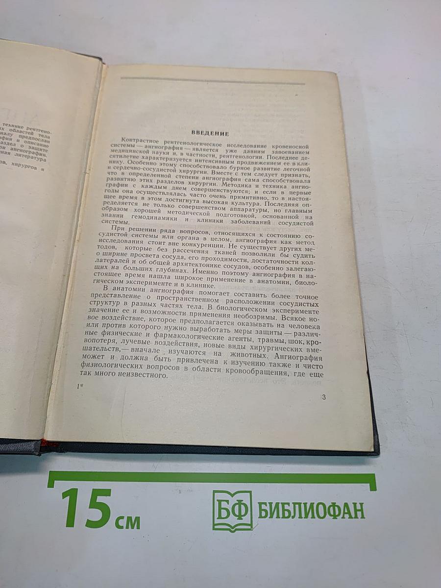 Ангиография