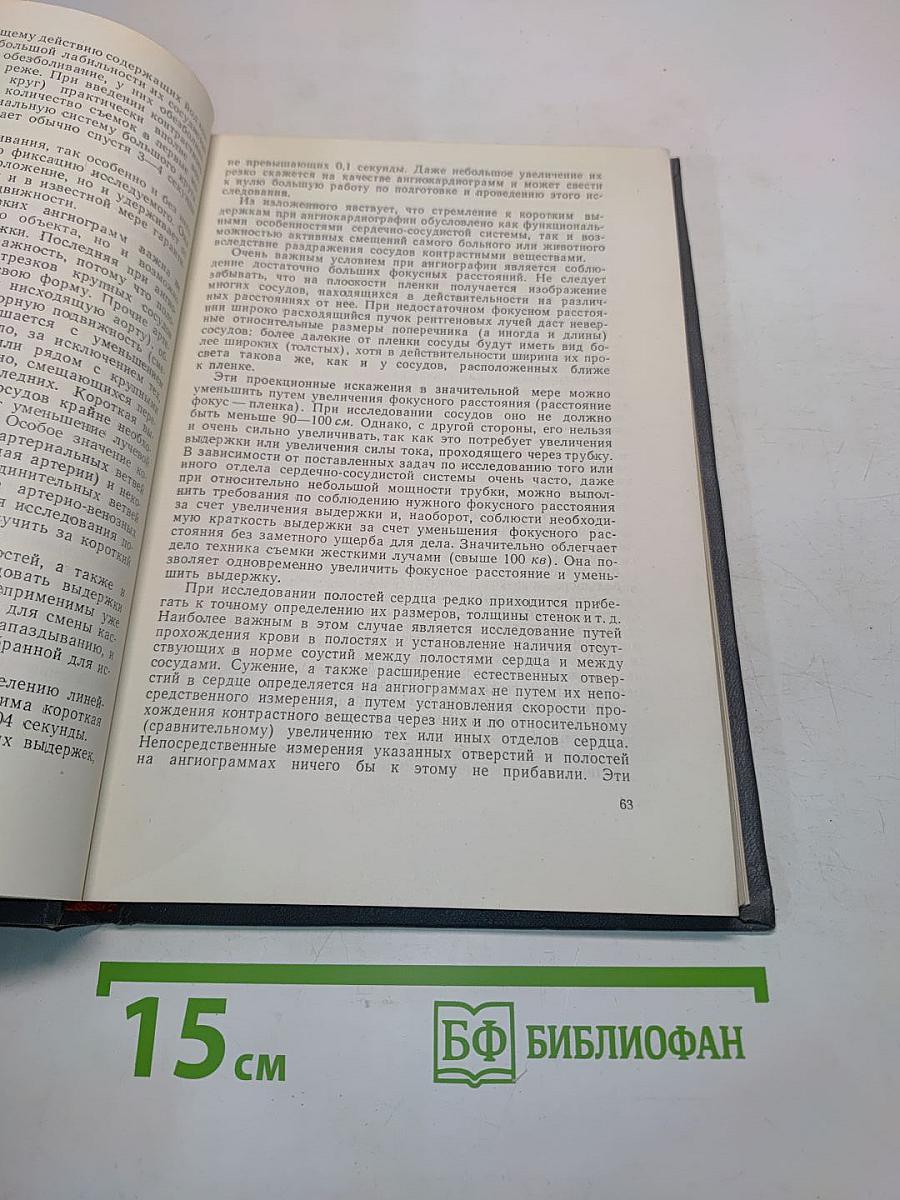 Ангиография