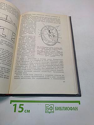 Ангиография