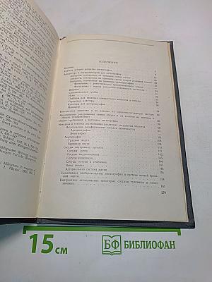 Ангиография