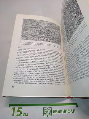 Атеросклероз