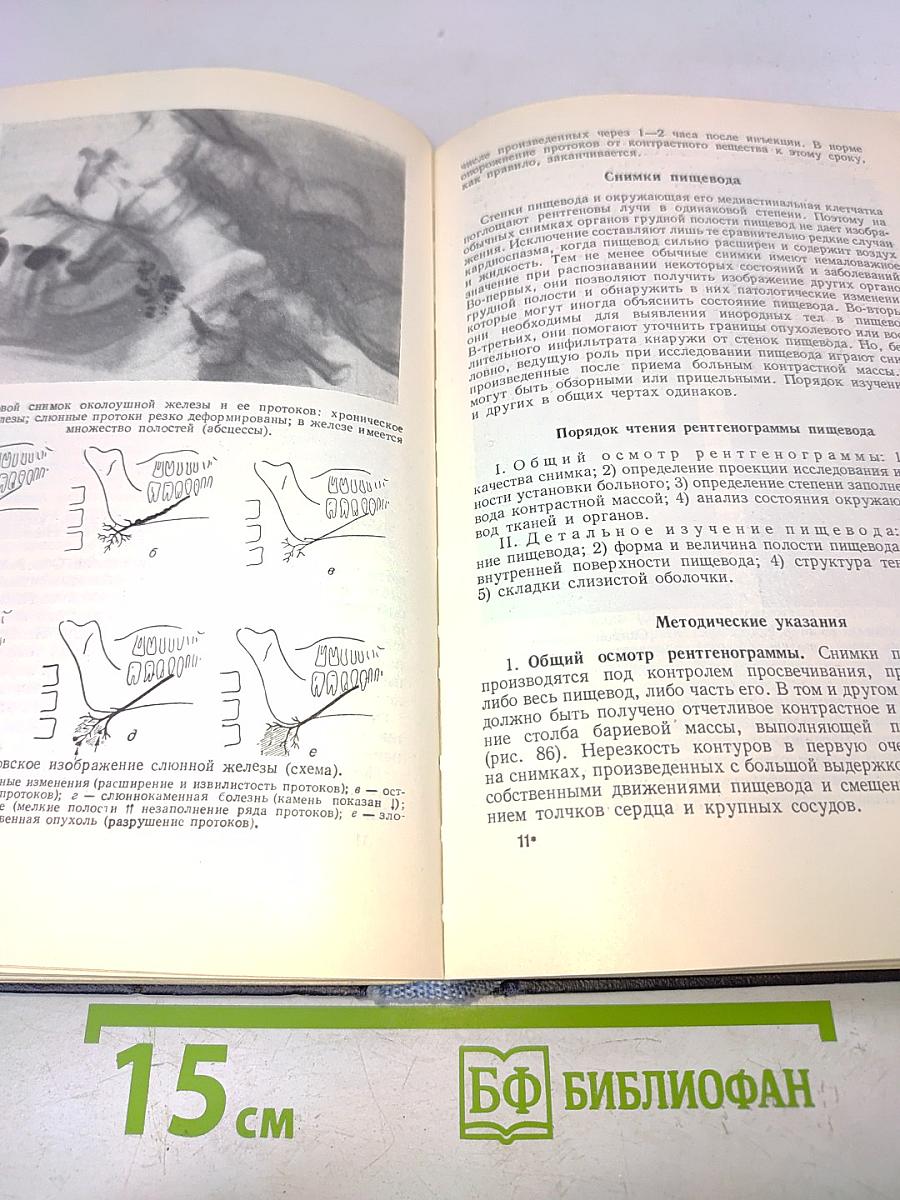 Методика чтения рентгеновских снимков