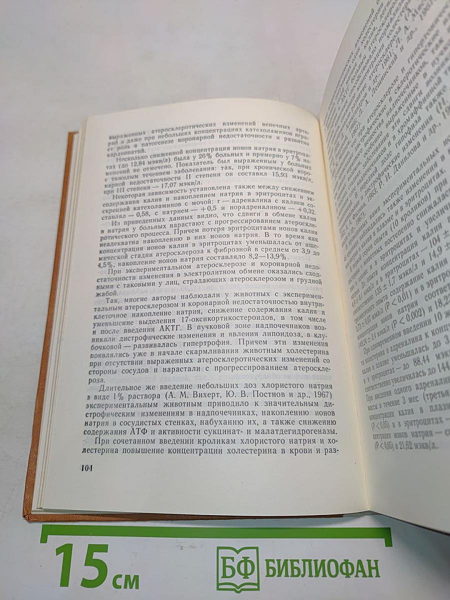 Атеросклероз