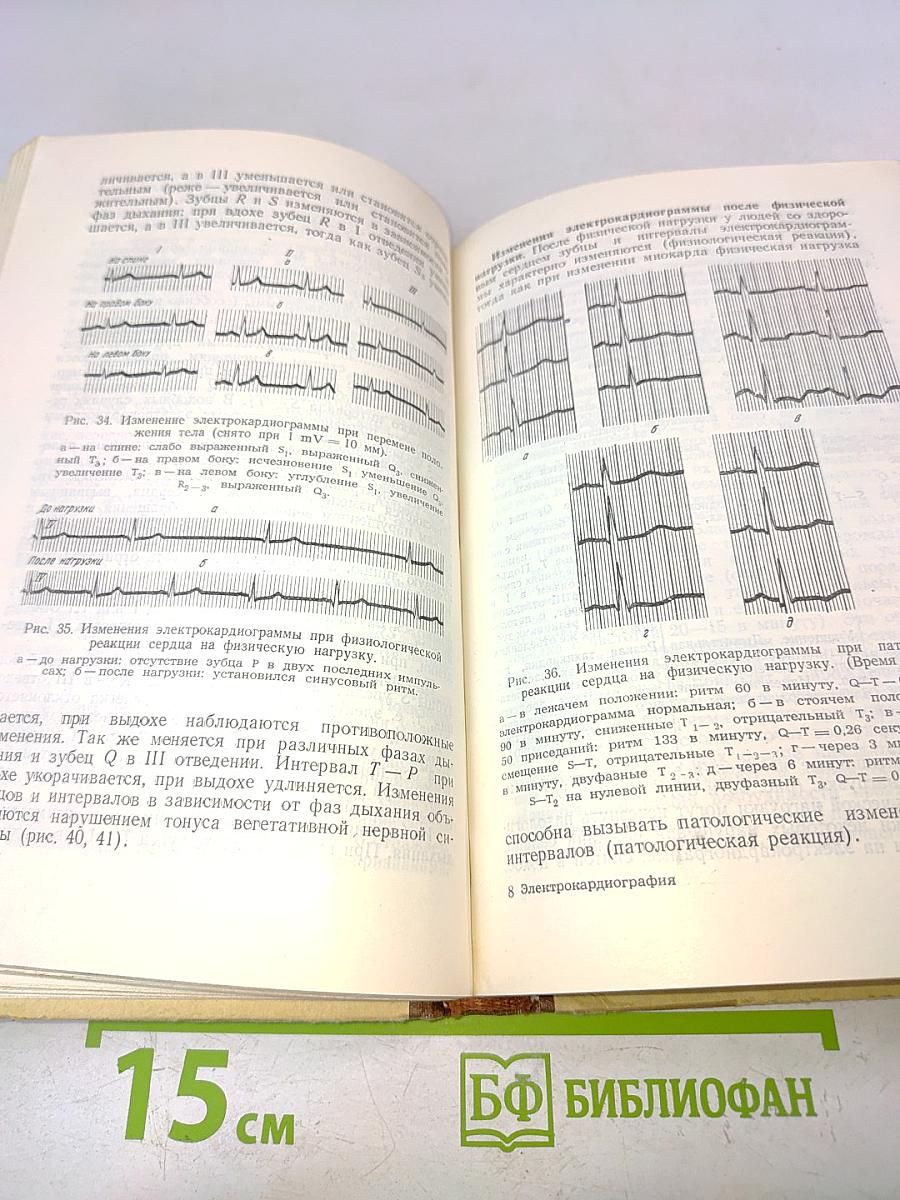 Электрокардиография (Методика и практика)