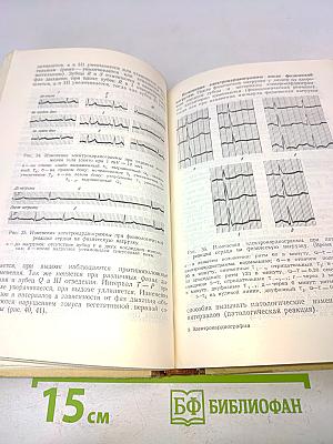 Электрокардиография (Методика и практика)