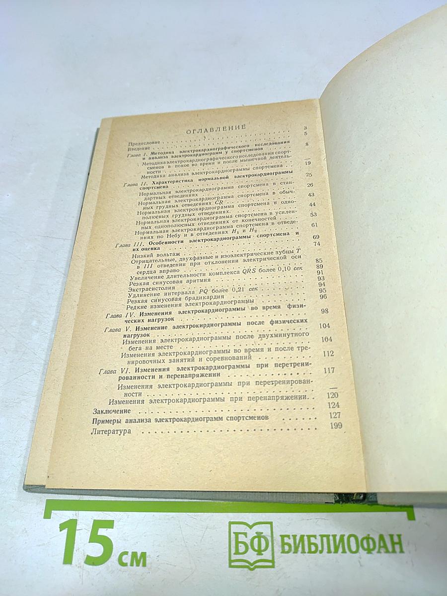 Электрокардиография в спортивной медицине
