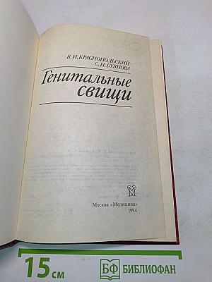 Генитальные свищи
