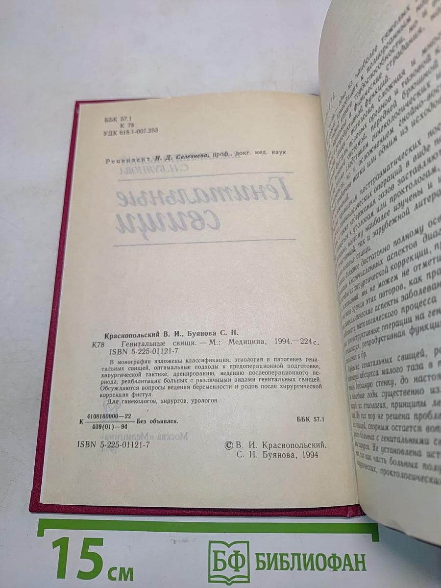 Генитальные свищи