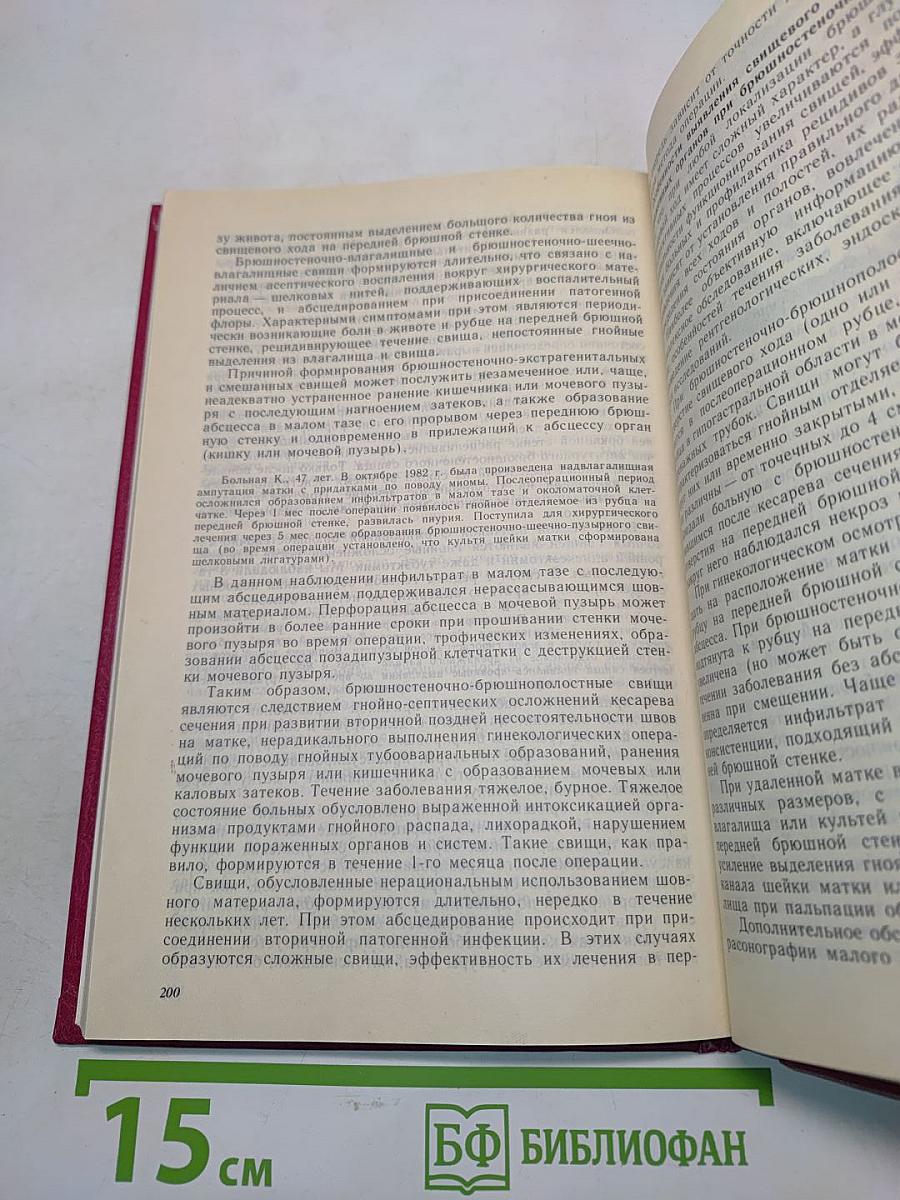 Генитальные свищи