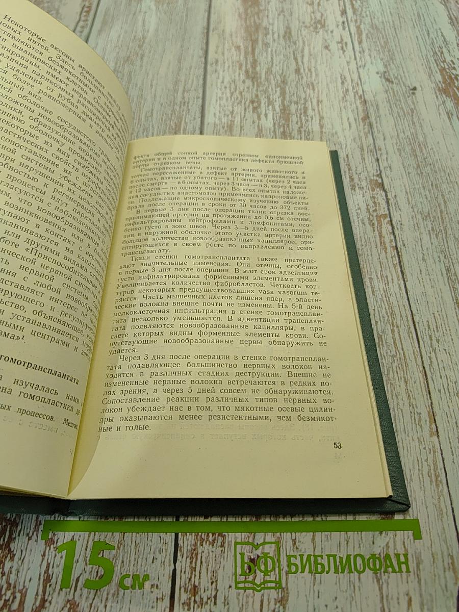 Иннервация и кровоснабжение пересаженных сосудов и конечностей