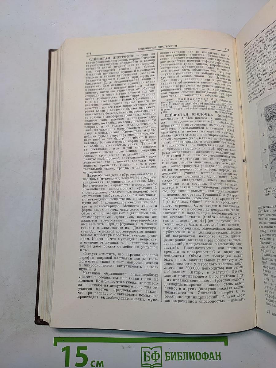 Большая медицинская энциклопедия. Том 30. Серотонин - Spina ventosa