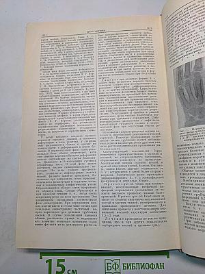 Большая медицинская энциклопедия. Том 30. Серотонин - Spina ventosa