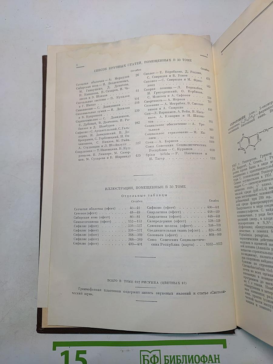 Большая медицинская энциклопедия. Том 30. Серотонин - Spina ventosa