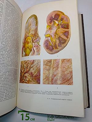 Большая медицинская энциклопедия. Том 6. Вульва-Гинантроп
