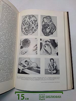 Большая медицинская энциклопедия. Том 6. Вульва-Гинантроп