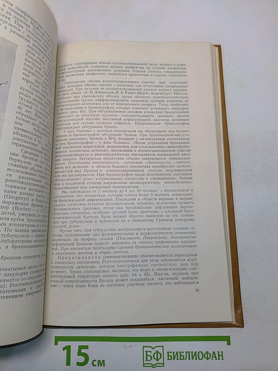 Бронхоскопия и бронхография