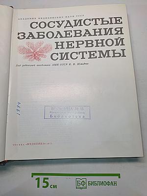 Сосудистые заболевания нервной системы