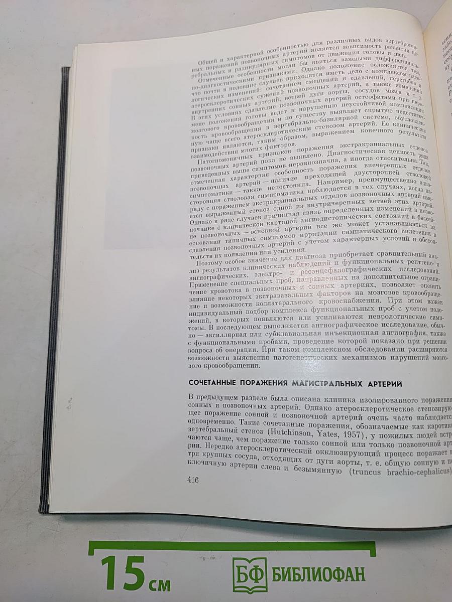 Сосудистые заболевания нервной системы