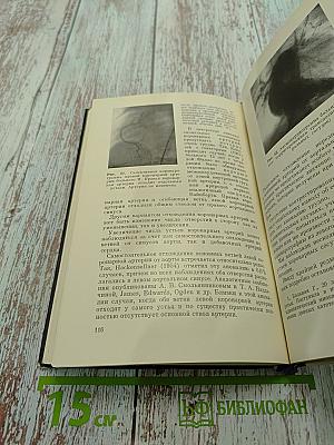 Коронарография