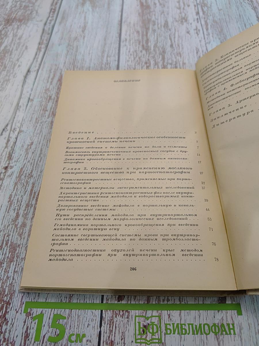 Ангиогепатография