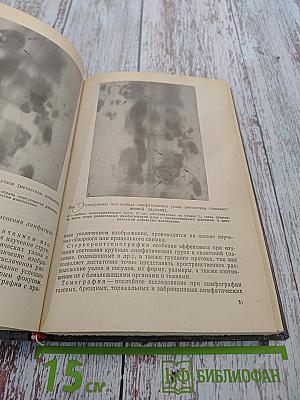 Клиническая лимфография
