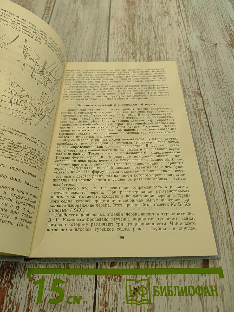 Краткое пособие по нейрорентгенологии