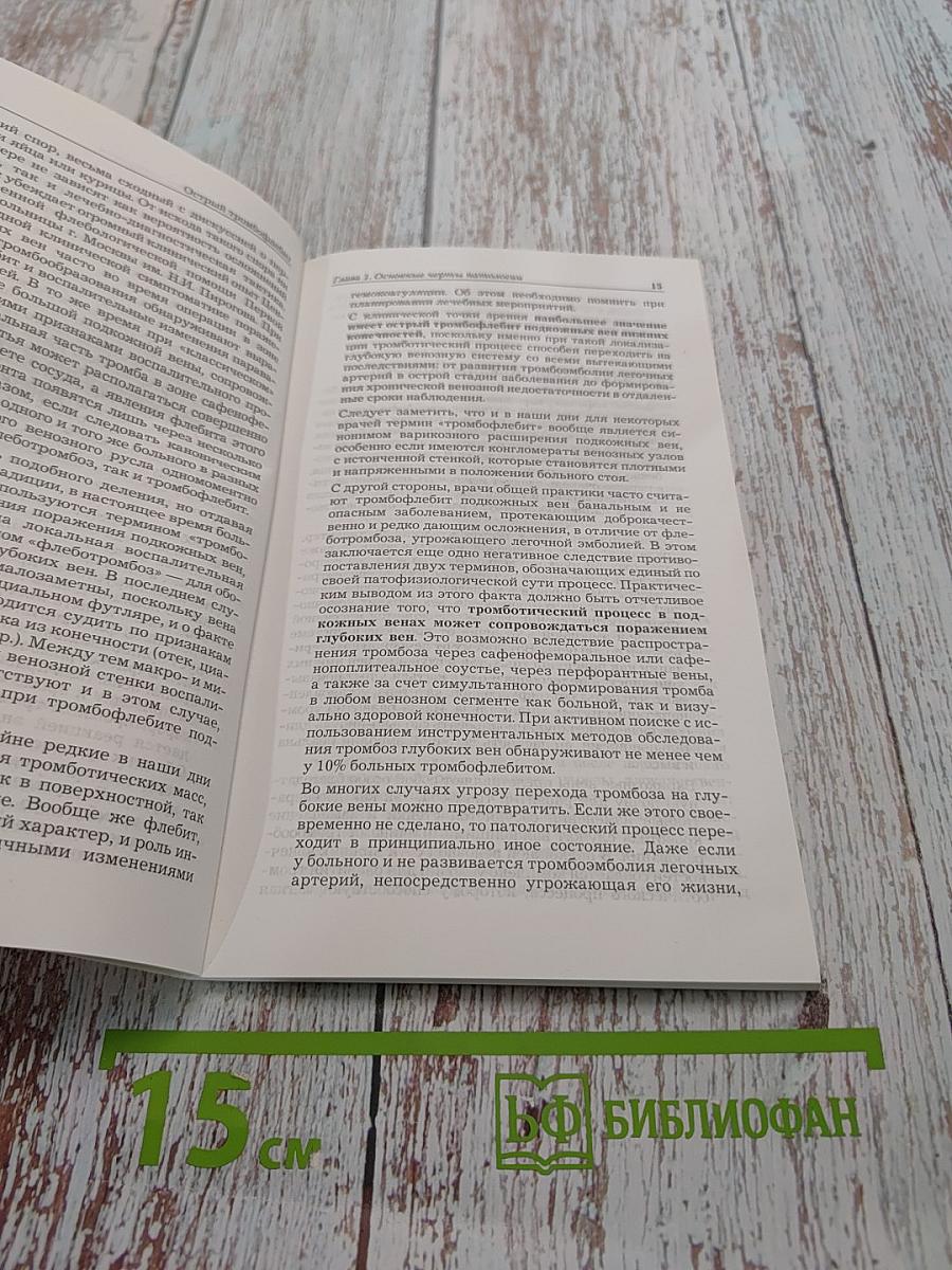 Острый тромбофлебит