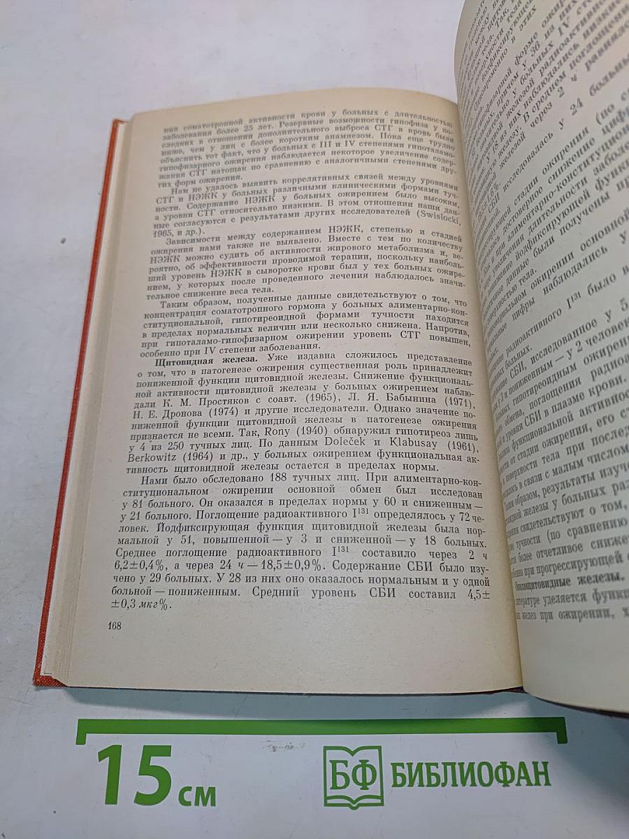 Ожирение