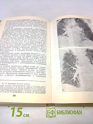 Массивная эмболия легочных артерий