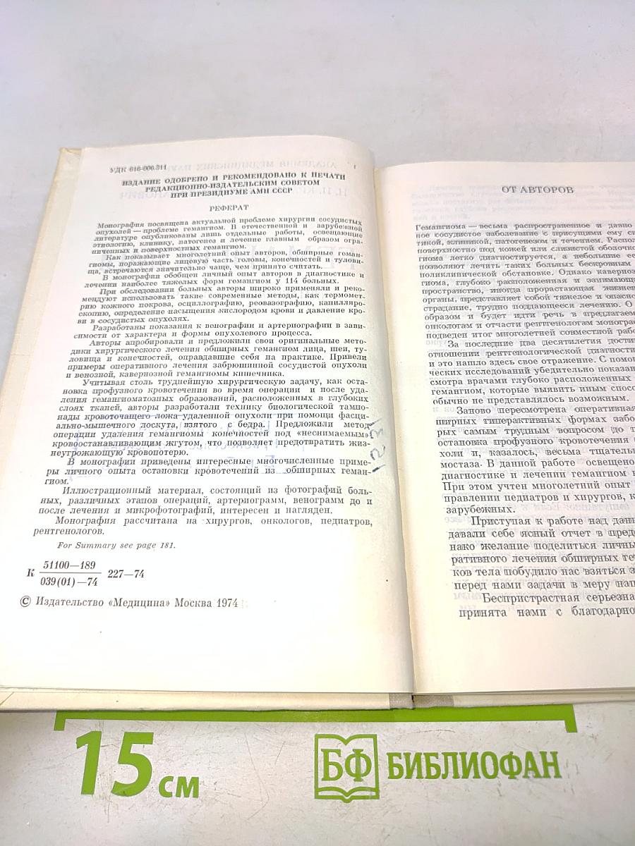 Гемагиомы (Диагностика и лечение)