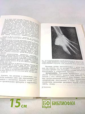 Гемагиомы (Диагностика и лечение)
