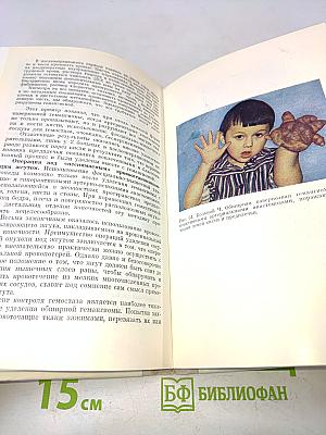 Гемагиомы (Диагностика и лечение)