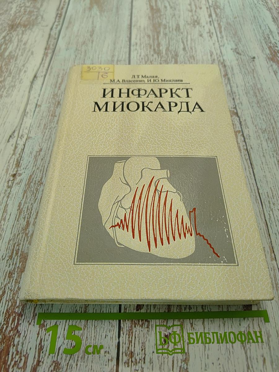 Инфаркт миокарда