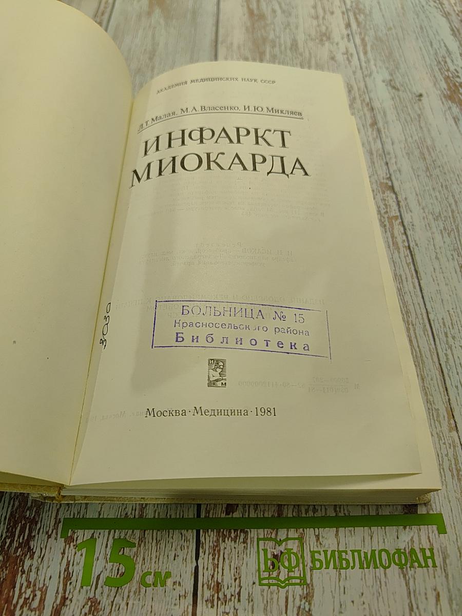 Инфаркт миокарда