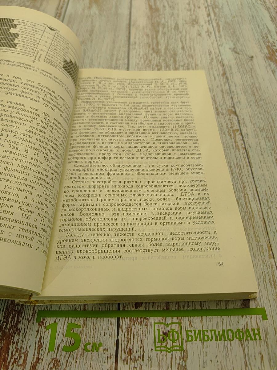 Инфаркт миокарда