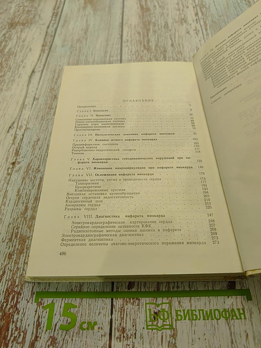 Инфаркт миокарда