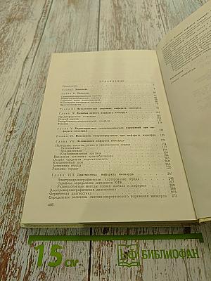 Инфаркт миокарда