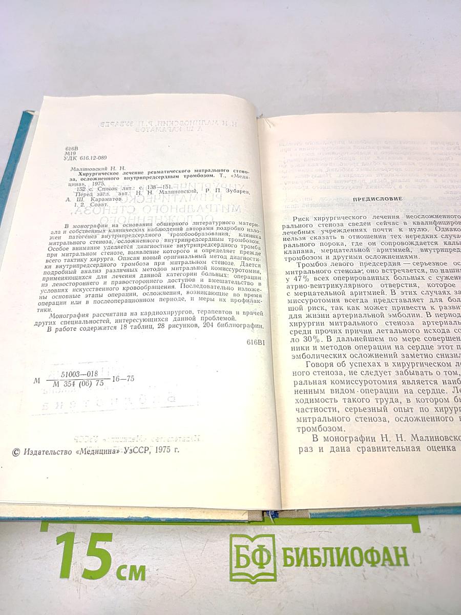 Хирургическое лечение ревматического митрального стеноза, осложненного внутрипредсердным тромбозом