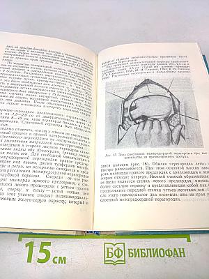 Хирургическое лечение ревматического митрального стеноза, осложненного внутрипредсердным тромбозом