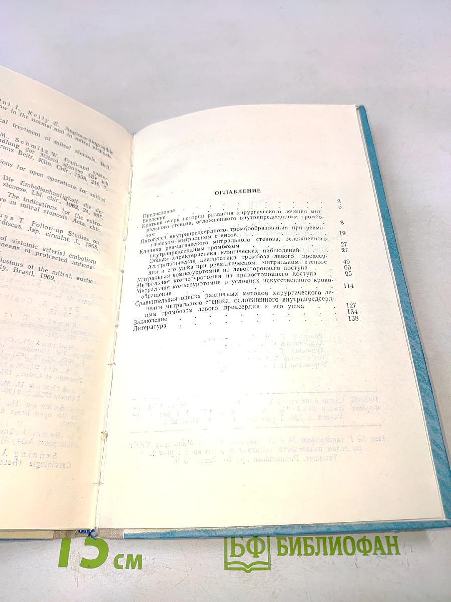 Хирургическое лечение ревматического митрального стеноза, осложненного внутрипредсердным тромбозом