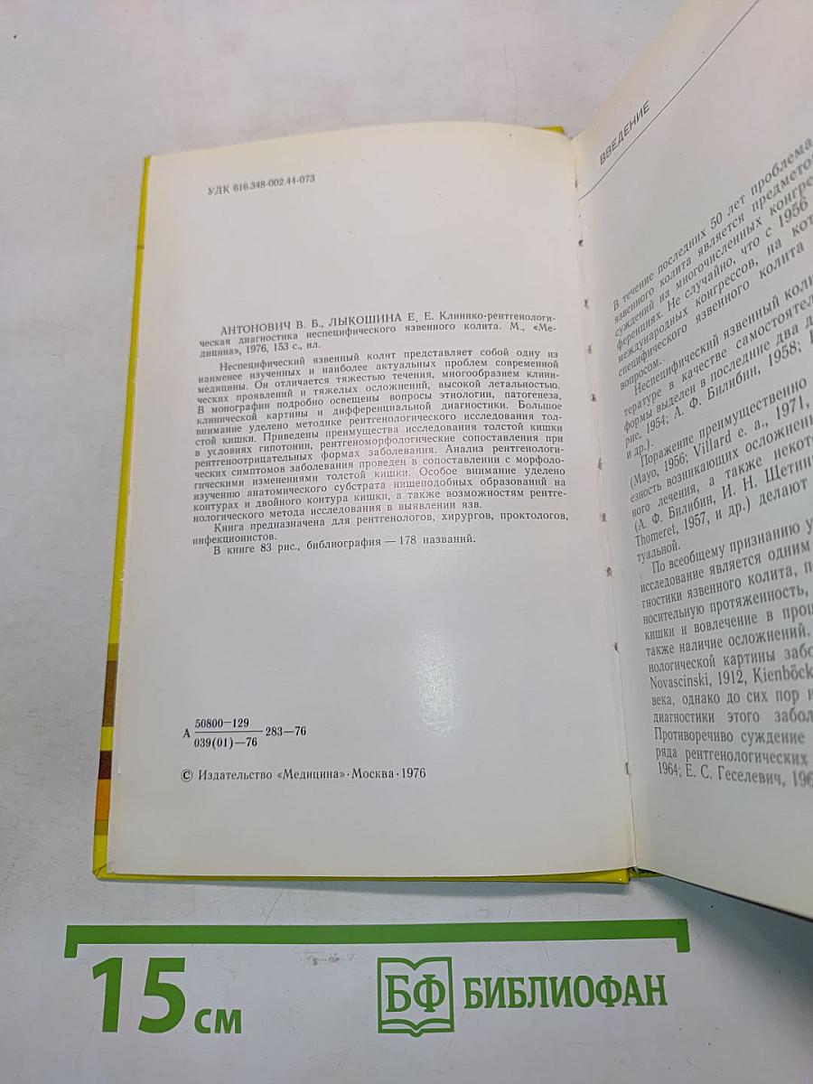 Клинико-рентгенологическая диагностика неспецифического язвенного колита