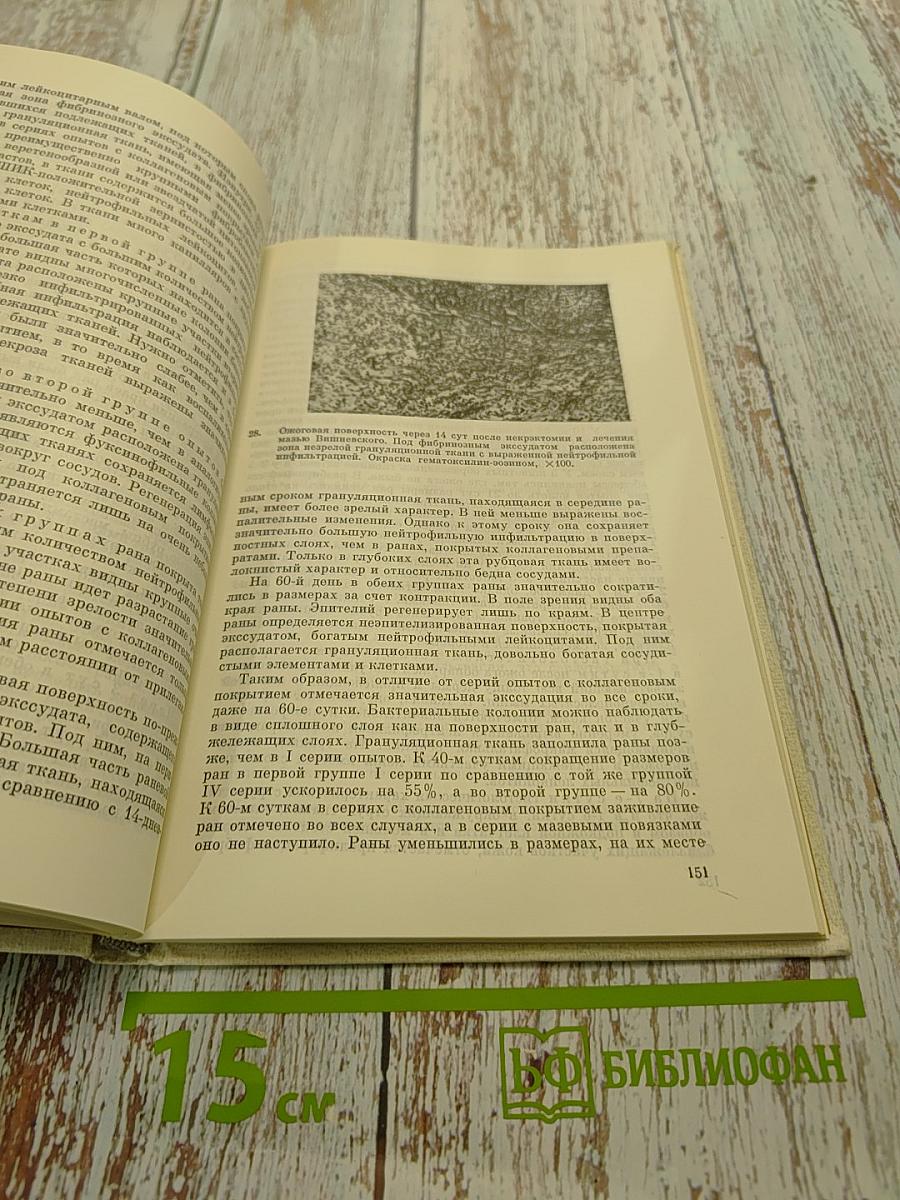 Коллагенопластика в медицине