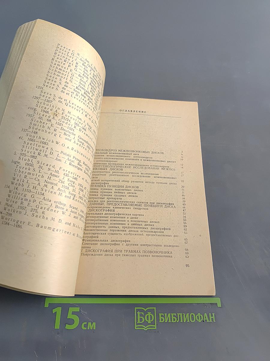 Дискография (диагностика позвоночных болей и радикулитов)