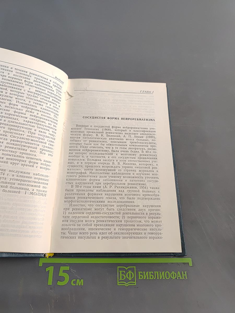 Ревматические заболевания нервной системы