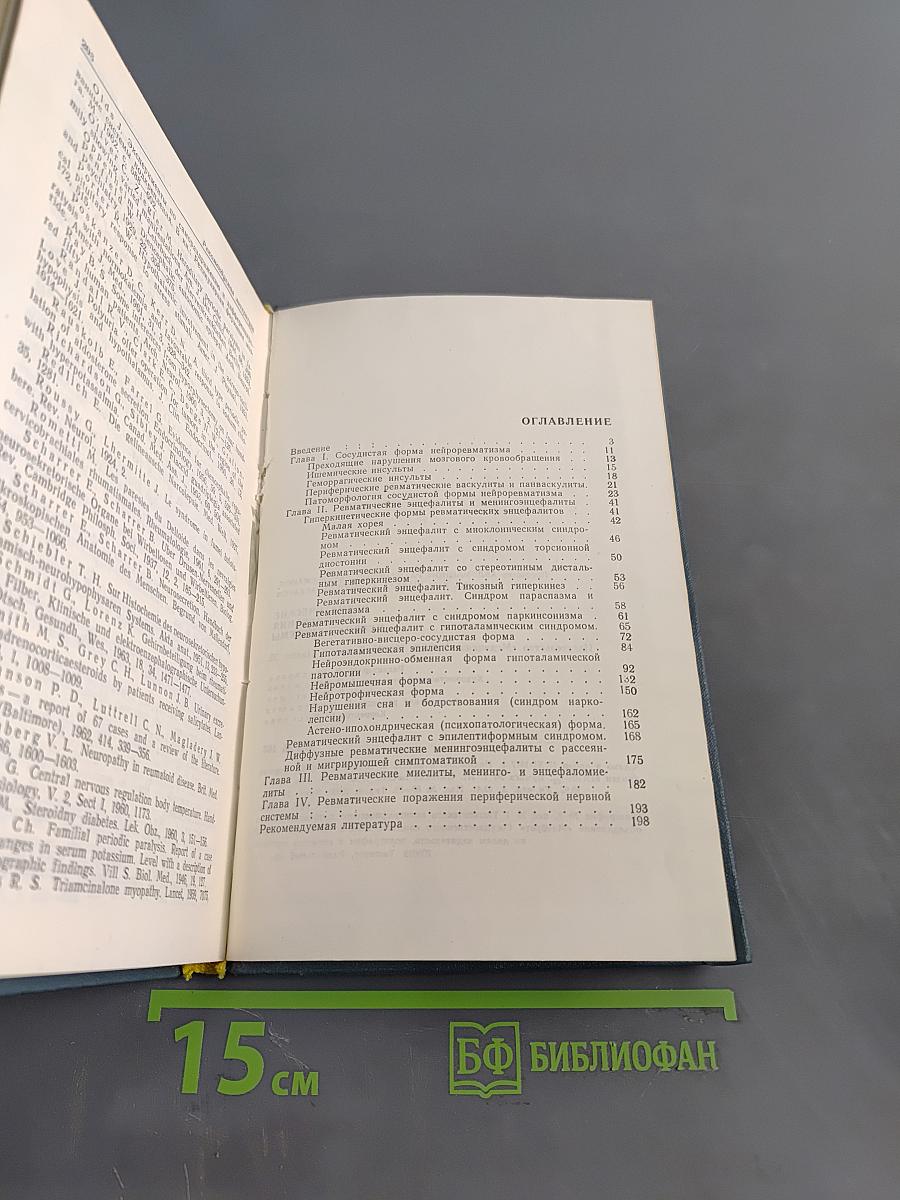 Ревматические заболевания нервной системы