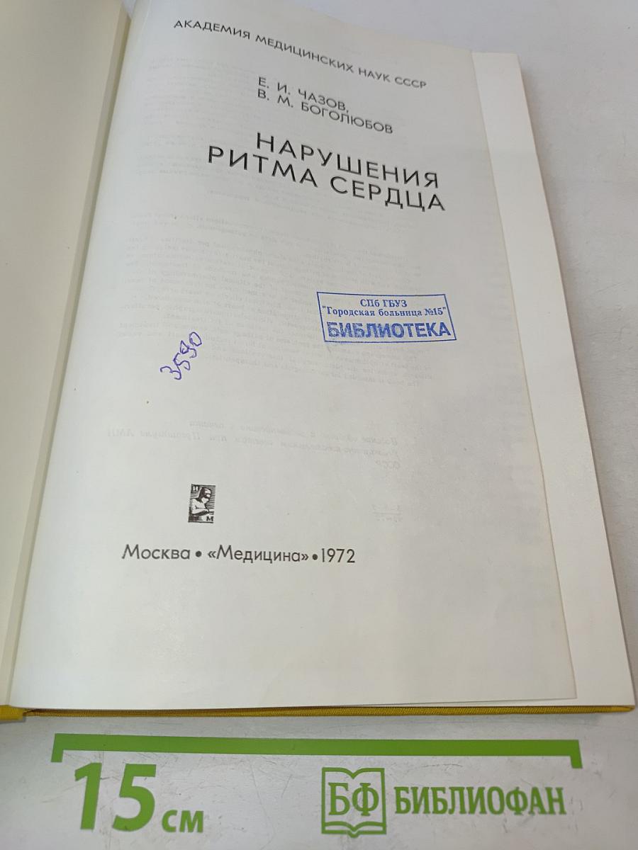 Нарушения ритма сердца
